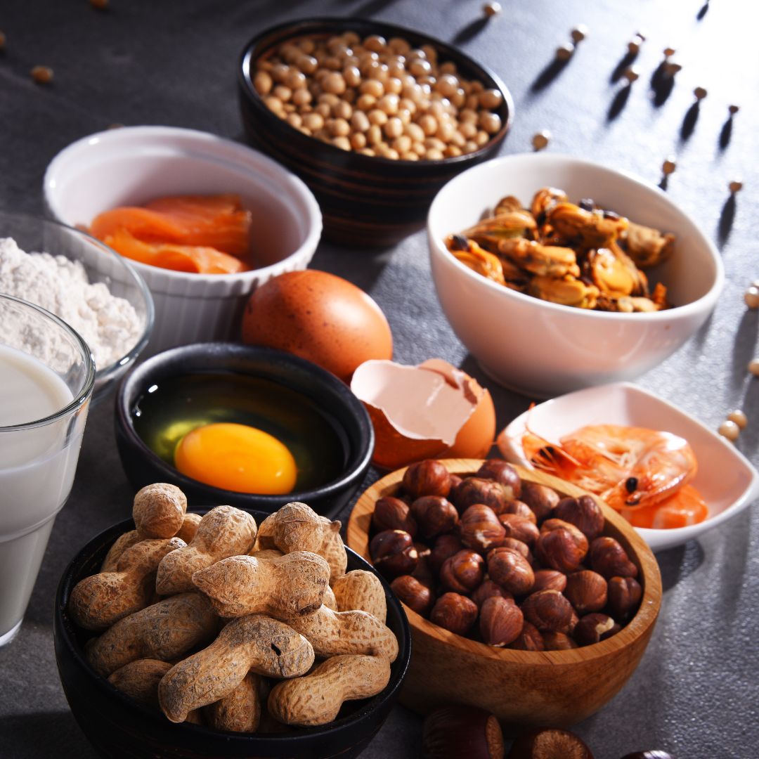 Curso Online de Alérgenos e Intolerancias Alimentarias